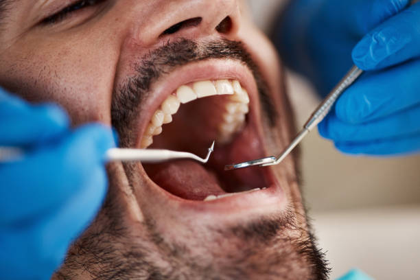 Best Emergency Dental Services for Seniors in Columbus, TX